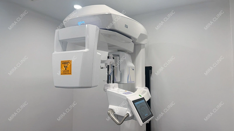 CBCT scan